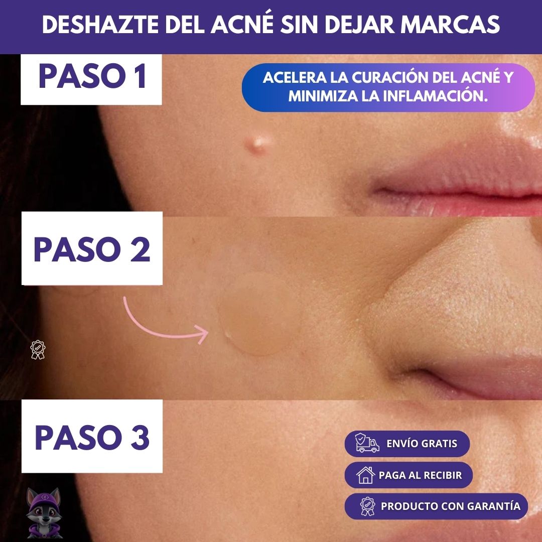 ClearAcne® - Pack 120 Parches Antigranos invisibles